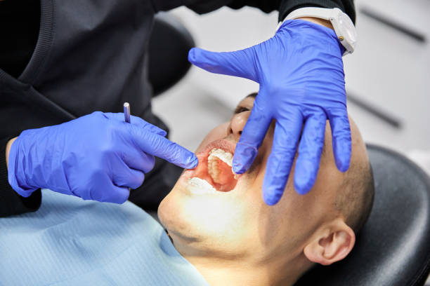 Best Emergency Treatment for Dental Infections or Abscesses in Arizona City, AZ